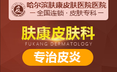 皮炎是什么原因造成的,皮炎的病因,黑龙江省皮肤病研究所,黑龙江省治皮肤病哪家医院好